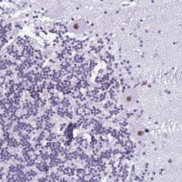 Anti-DHX15 antibody produced in rabbit 