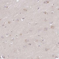 Anti-DIMT1 antibody produced in rabbit 
