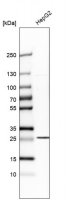 Anti-SLC25A10 antibody produced in rabbit 
