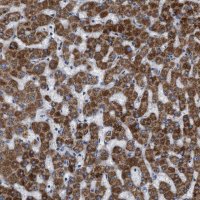 Anti-SLC25A13 antibody produced in rabbit 