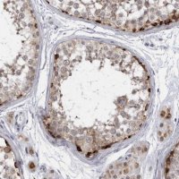 Anti-SLC25A22 antibody produced in rabbit 