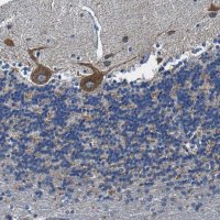 Anti-SLC25A25 antibody produced in rabbit 