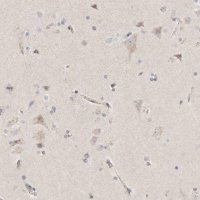 Anti-SLC25A26 antibody produced in rabbit 