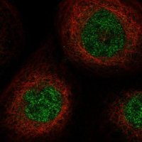 Anti-SLC25A43 antibody produced in rabbit 
