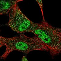 Anti-SLC25A45 antibody produced in rabbit 