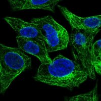 Anti-SLC26A1 antibody produced in rabbit 