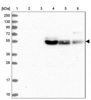 Anti-SLC2A10 antibody produced in rabbit 