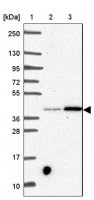 Anti-SLC39A3 antibody produced in rabbit 