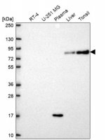 Anti-SLC3A1 antibody produced in rabbit HPA071102-100UL