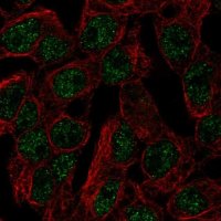 Anti-SLC5A11 antibody produced in rabbit 