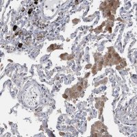 Anti-SLCO4A1 antibody produced in rabbit 