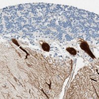 Anti-SLFN12 antibody produced in rabbit 