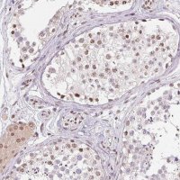 Anti-SMIM12 antibody produced in rabbit 