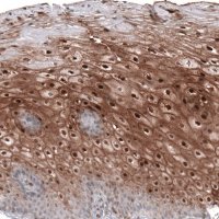 Anti-SMYD2 antibody produced in rabbit 