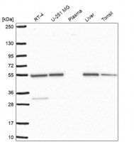 Anti-SMYD3 antibody produced in rabbit 