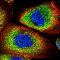 Anti-SNRPD2 antibody produced in rabbit HPA041437-100UL