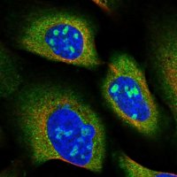 Anti-SNX15 antibody produced in rabbit 