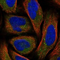Anti-SRD5A3 antibody produced in rabbit 