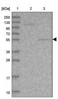 Anti-SRPX2 antibody produced in rabbit HPA038786-100UL