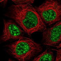 Anti-SRRM1 antibody produced in rabbit 
