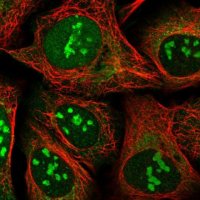 Anti-SS18L2 antibody produced in rabbit 