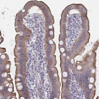 Anti-SSTR1 antibody produced in rabbit 