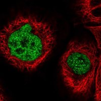 Anti-ST7 antibody produced in rabbit 