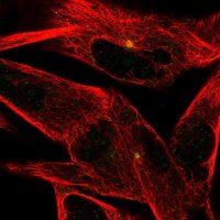 Anti-ST8SIA2 antibody produced in rabbit 