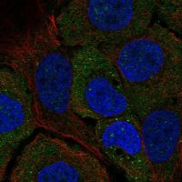 Anti-STARD5 antibody produced in rabbit 
