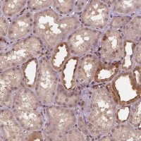 Anti-STAT3 antibody produced in rabbit HPA001671-100UL