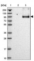 Anti-STOX2 antibody produced in rabbit HPA049776-100UL