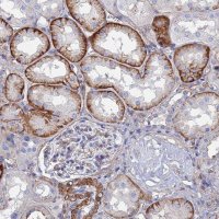 Anti-STRA6 antibody produced in rabbit 