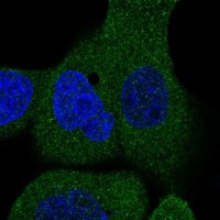 Anti-STRIP2 antibody produced in rabbit 