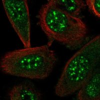 Anti-STYXL1 antibody produced in rabbit 