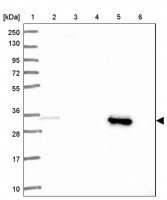 Anti-SULT1A2 antibody produced in rabbit 