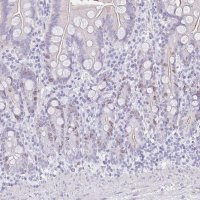 Anti-SUZ12 antibody produced in rabbit 