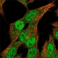Anti-SV2C antibody produced in rabbit HPA040722-100UL