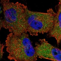 ANTI-SWT1 antibody produced in rabbit 