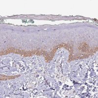 Anti-SYS1 antibody produced in rabbit 