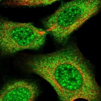 Anti-TAB3 antibody produced in rabbit 