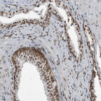 Anti-TADA2B antibody produced in rabbit 