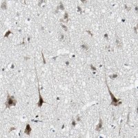 Anti-TAF6 antibody produced in rabbit HPA006566-100UL