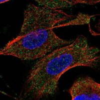 Anti-TARSL2 antibody produced in rabbit 