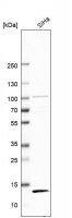 Anti-TAX1BP3 antibody produced in rabbit 