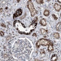 Anti-TBC1D15 antibody produced in rabbit 