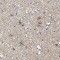 Anti-TBC1D32 antibody produced in rabbit HPA013413-100UL