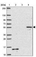 Anti-TBX15 antibody produced in rabbit 