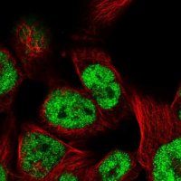 Anti-TCEAL8 antibody produced in rabbit 