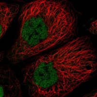 Anti-TCF20 antibody produced in rabbit 