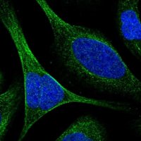 Anti-TCTN3 antibody produced in rabbit 